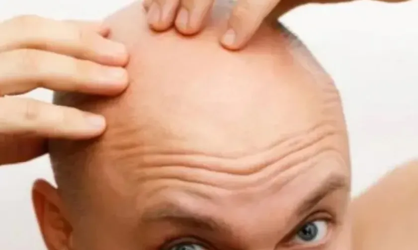 pelado
